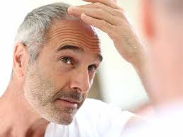 hair loss due to chemical processes